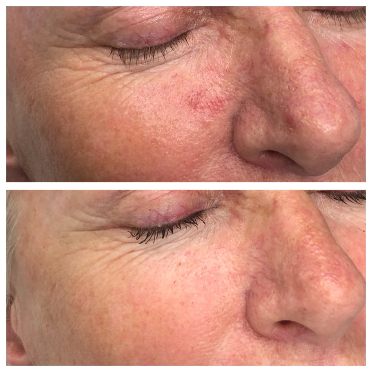 Adashiko Marine Collagen Powder Joints - image 2