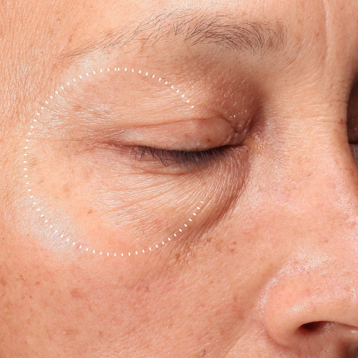Medik8 Crystal Retinal Ceramide Eye 6
