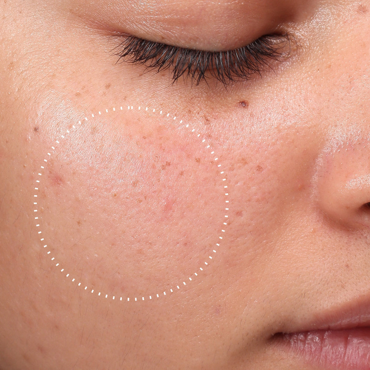 Medik8 Press & Clear Refill